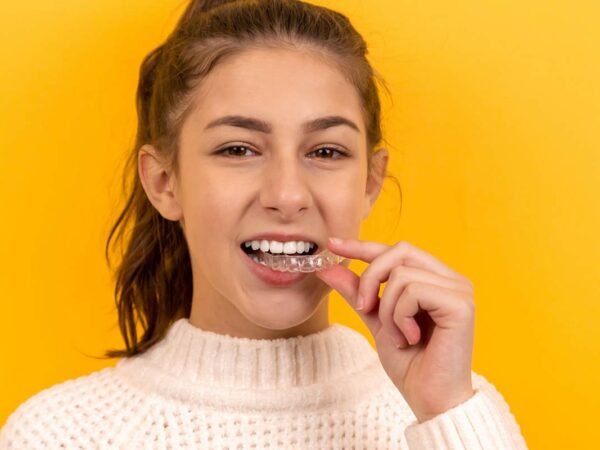How Much Are Braces in California? 2023 Cost Guide