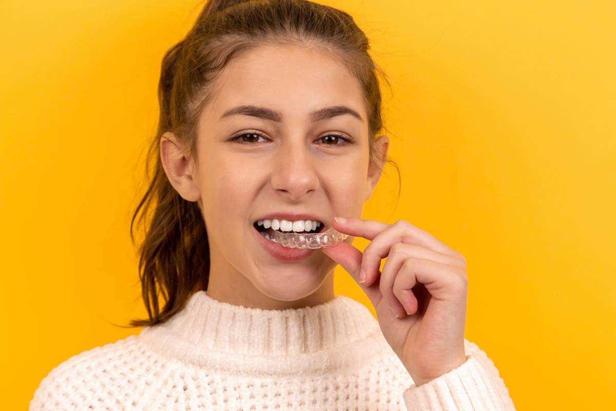 How Much Are Braces in California? 2023 Cost Guide