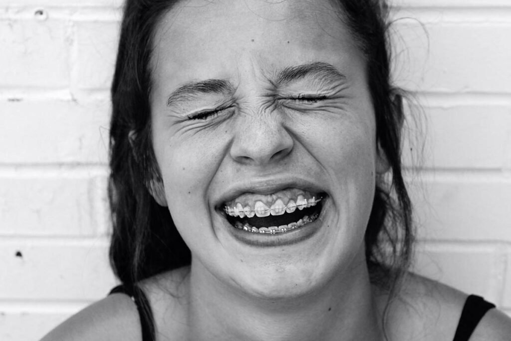 How Much Are Braces in California 