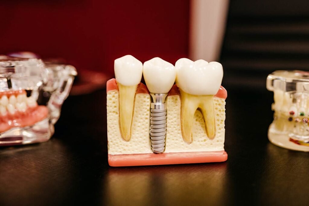 How Much Does a Dental Assistant Make in California 